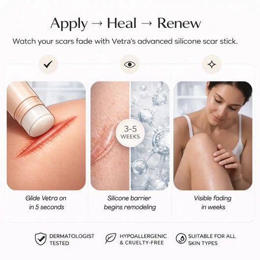 Vetra™ Scar Solutions Silicone Stick
