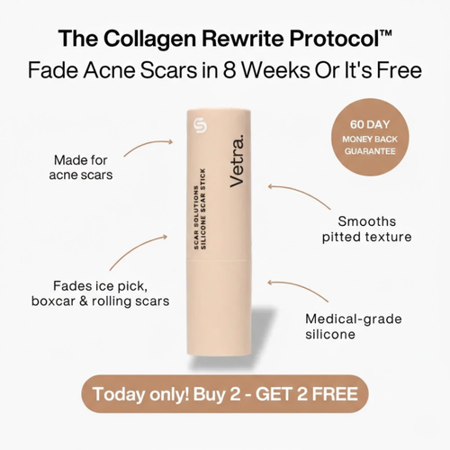 Vetra™ Acne Scar Remodeling Stick