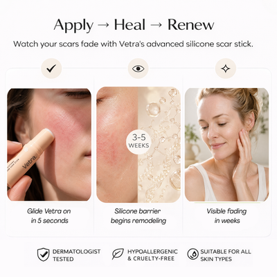 Vetra™ Silicone Rosacea Corrector