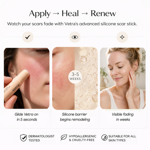 Vetra™ Silicone Rosacea Corrector