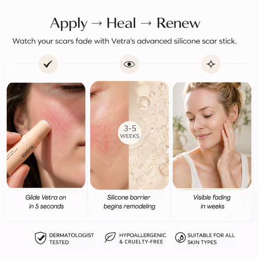 Vetra™ Silicone Rosacea Corrector
